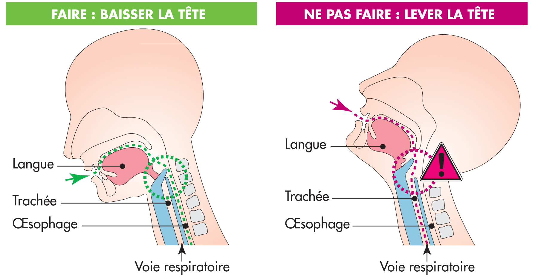 Comment éviter une fausse route